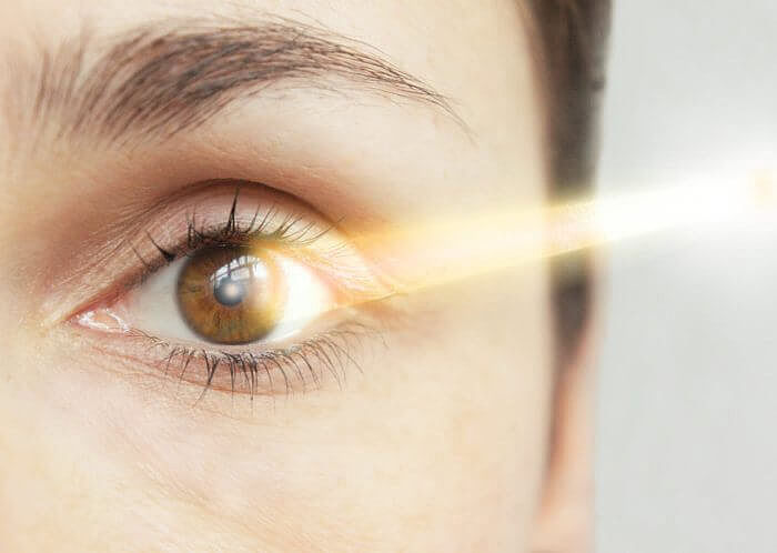 Angedeuteter Laserstrahl beim Augenlasern